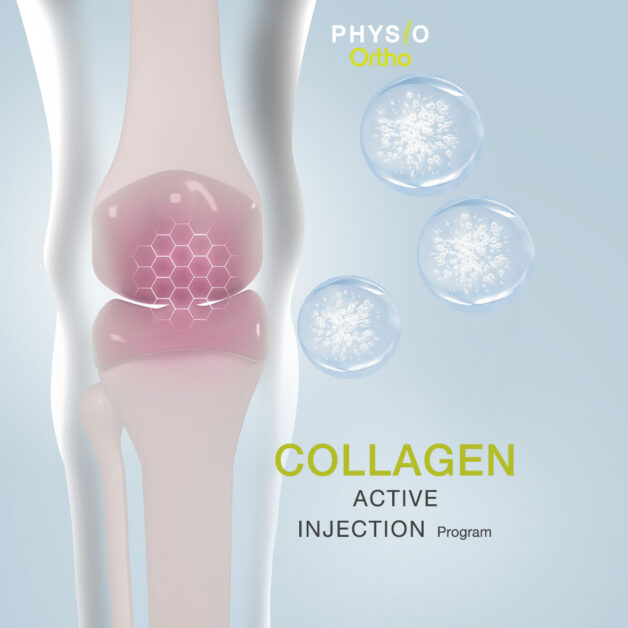 Collagen Active Injection Program (1CC)