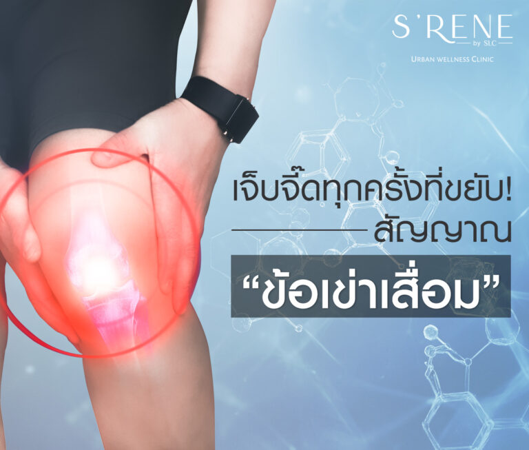 ข้อเข่าเสื่อม Knee Osteoarthritis