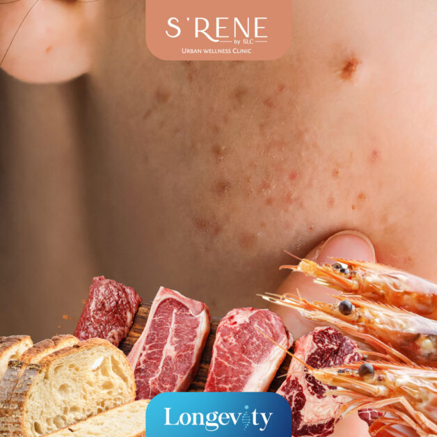 IgG Food Intolerance Test Program