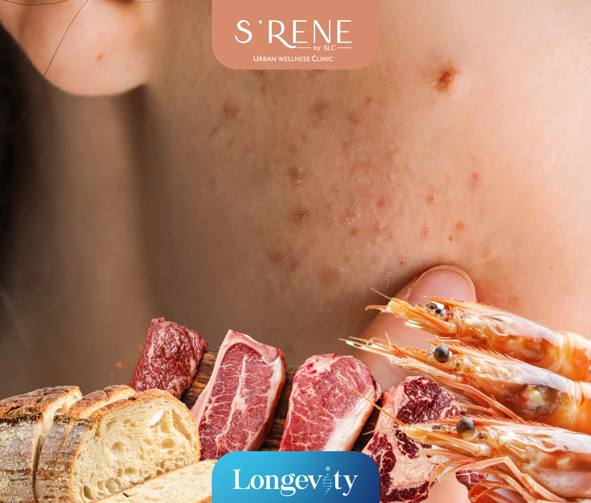 IgG Food Intolerance Test Program