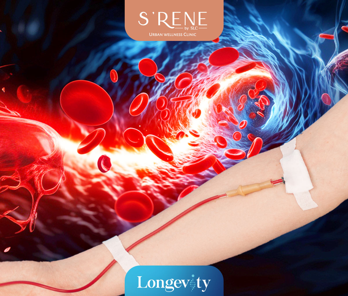 Double Filtration Plasmapheresis Program (DFPP)