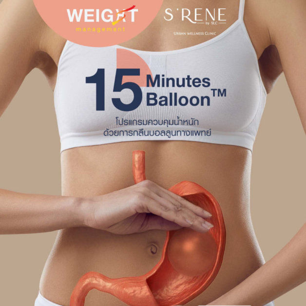 15 Minutes Balloon™ โปรแกรม กลืนบอลลูน คุมน้ำหนัก ไม่ต้องผ่าตัด