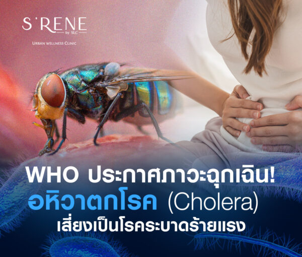 อหิวาตกโรค