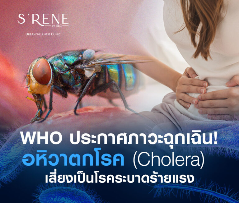 อหิวาตกโรค