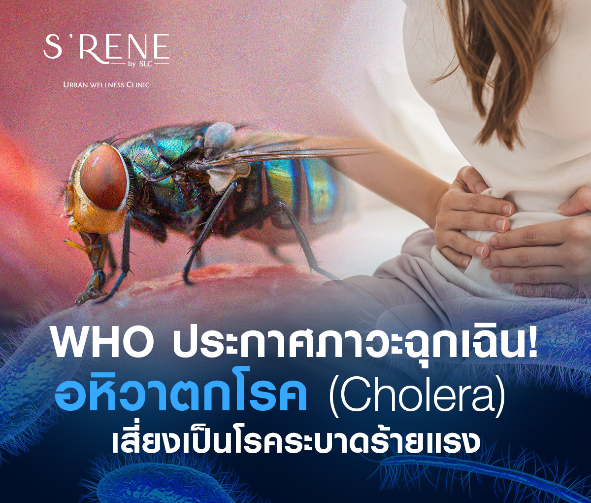 อหิวาตกโรค