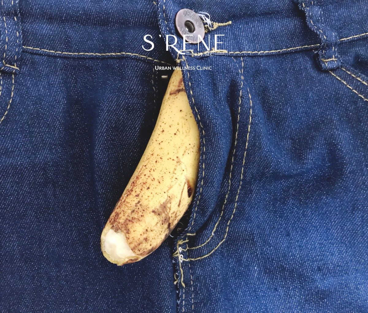 โปรแกรม ขลิบปลายอวัยวะเพศชาย เทคนิค Kaizen Master™ แผลเล็ก ฟื้นตัวไว