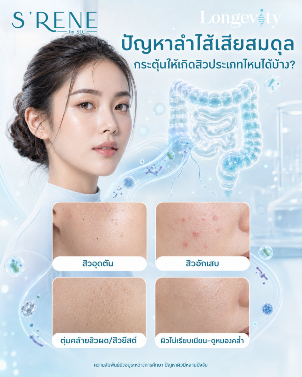 ผิวพัง เป็นสิวไม่หาย อาจเพราะลำไส้พัง! เจาะลึกความลับ Gut-Skin Connection พร้อมทางลัดฟื้นฟูผิวด้วย COLON HYDROTHERAPY PROGRAM ที่ S’RENE by SLC